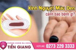 thumbbnail