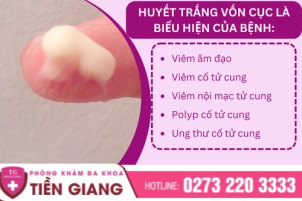 thumbbnail