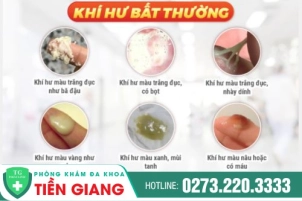 thumbbnail