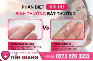 thumbbnail