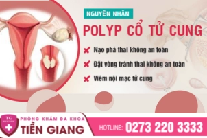 thumbbnail