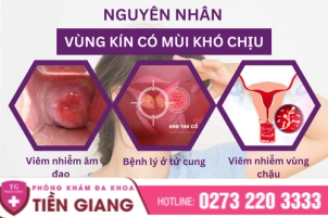 thumbbnail