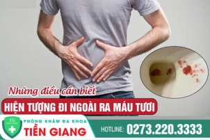 Đi Ngoài Ra Máu Là Gì? Tại Sao Đi Ngoài Bị Ra Máu Và Điều Trị Ở Đâu Cho An Tâm