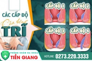 Bệnh Trĩ Là Gì? Hiểu Tất Tần Tật Về Bệnh Trĩ