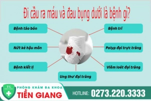 Đau Bụng Đi Cầu Ra Máu Là Bệnh Gì Gây Ra ? Cần Đi Khám Ngay Nếu Có Triệu Chứng Nguy Hiểm