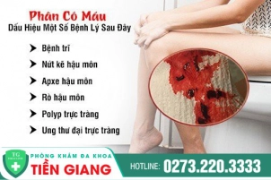 Phân Có Máu Là Do Bệnh Gì? Nguyên Nhân Gây Ra, Tác Hại Và Cách Điều Trị