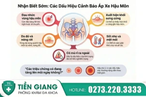 Hình ảnh áp xe hậu môn thường gặp và cách phân biệt với bệnh trĩ