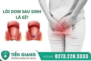 Bị lòi dom sau khi sinh: Nỗi khổ thầm lặng của nhiều mẹ bỉm