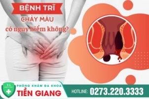 Bệnh Trĩ Ra Máu Là Do Bệnh Gì? Có Nguy Hiểm Không? Cách Điều Trị An Toàn