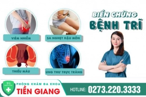 Bị Trĩ Phải Làm Sao Để Mau Khỏi ? Nguyên Nhân Và Cách Điều Trị