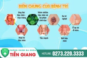 Bệnh Trĩ Là Bệnh Lý Gì? Nếu Không Chữa Trị Có Nguy Hiểm Không