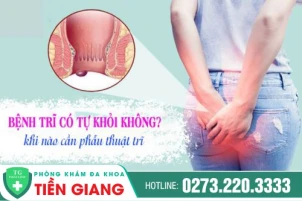 Bệnh trĩ có tự khỏi không? Điều trị như thế nào hiệu quả?