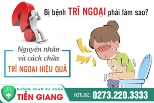 Xem Ngay Những Nguyên Nhân Dẫn Đến Bệnh Trĩ Ngoại Và Cách Khắc Phục