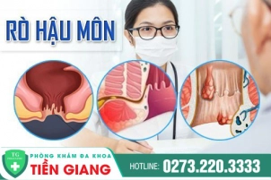 Tổng Quan Về Bệnh Rò Hậu Môn: Nguyên Nhân, Dấu Hiệu, Cách Điều Trị