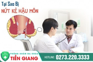 Nguyên Nhân Nứt Kẽ Hậu Môn Và Tác Hại Nguy Hiểm
