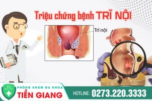 Biểu Hiện Trĩ Nội Dễ Nhận Biết Người Bệnh Thường Chủ Quan