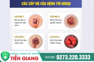 Những Thông Tin Về Bệnh Trĩ Ngoại Và Phương Pháp Điều Trị Tại Nhà