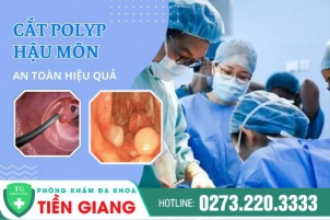 Cắt Polyp Hậu Môn Ở Đâu An Toàn Hiệu Quả Và Chi Phí Bình Dân