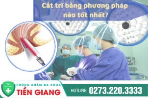 Phẫu Thuật Cắt Trĩ Với Phương Pháp Nhanh Hồi Phục Cùng Bác Sĩ Chuyên Khoa Kinh Nghiệm