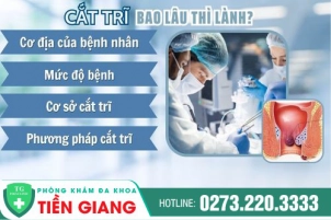 Mổ Trĩ Bao Lâu Thì Lành? Nên Mổ Trĩ Bằng Phương Pháp Nào?
