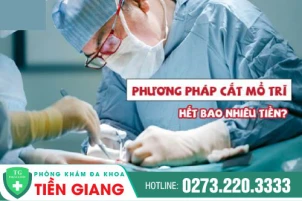 Chữa trĩ có đắt không? Các phương pháp điều trị trĩ hiệu quả