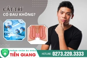 Cắt Trĩ Có Đau Không? Tìm Hiểu Về Những Phương Pháp Cắt Trĩ Hiện Đại Tiến Tiến, Thoát Khỏi Lo Âu