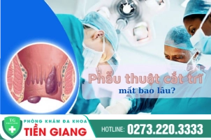 Phẫu Thuật Cắt Trĩ Mất Bao Lâu? Nên Cắt Trĩ Bằng Phương Pháp Nào?