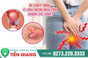 Chảy Máu Hậu Môn: Nguyên Nhân Và Cách Khắc Phục