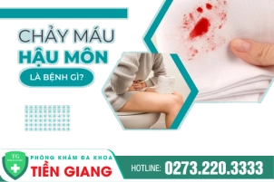 Nguyên Nhân Dẫn Đến Chảy Máu Hậu Môn Phổ Biến Hiện Nay