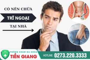 Có Nên Điều Trị Trĩ Ngoại Tại Nhà? Những Mối Nguy Hiểm Nếu Không Điều Trị Đúng Cách