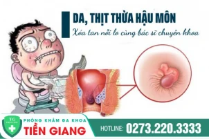 Xóa Tan Nỗi Lo Da Thừa Hậu Môn Cùng Bác Sĩ Chuyên Khoa