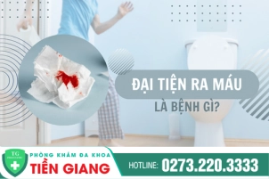 Đi Đại Tiện Ra Máu - Dấu Hiệu Cảnh Báo Bệnh Hậu Môn Trực Tràng