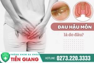 Hậu Môn Bị Đau Là Dấu Hiệu Mắc Bệnh Gì? Điều Trị Ra Sao