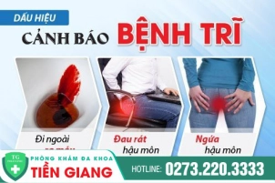 Bệnh Trĩ Là Như Thế Nào? Phương Pháp Điều Trị Bệnh Trĩ Hiệu Quả Hiện Nay