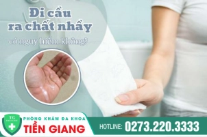 Xuất Hiệu Dịch Nhầy Màu Trắng Đục Khi Đi Cầu Là Dấu Hiệu Của Bệnh Lý Nào?