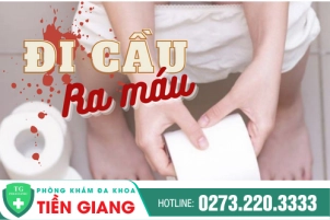Những Nguyên Nhân Đi Ngoài Ra Máu Mà Ai Cũng Nên Biết