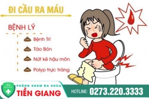 Tìm Hiểu Nguyên Nhân Dẫn Đến Tình Trạng Ỉa Ra Máu