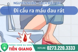 Khuyến Cáo Của Bác Sĩ Về Hiện Tượng Đi Cầu Ra Máu Đau Rát