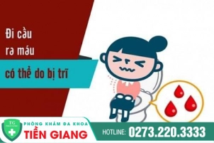 Bị Bệnh Trĩ Đi Cầu Ra Máu - Xem Ngay Giải Pháp An Toàn Hiệu Quả Mong Đợi