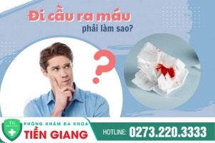Chữa Đi Cầu Ra Máu Như Thế Nào? Cần Làm Gì Khi Có Dấu Hiệu Đi Cầu Ra Máu