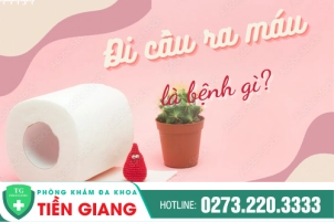 Các Tác Nhân Gây Đi Cầu Ra Máu Mà Người Bệnh Không Nên Chủ Quan