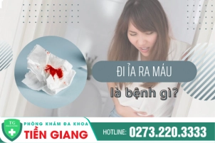 Đi Ỉa Ra Máu - Tình Trạng Báo Động Không Nên Chủ Quan