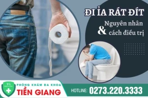 Thoát Khỏi Nỗi Lo Ỉa Rát Đít Với Các Phương Pháp Điều Trị Tiên Tiến