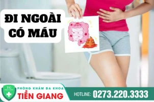 Đi ngoài có máu là do đâu? Điều trị như thế nào hiệu quả?