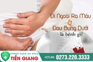 Đau bụng đi ngoài ra máu là bệnh gì? Điều trị bằng phương pháp gì?