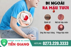 Đi Ngoài Chảy Máu Là Dấu Hiệu Mắc Bệnh Gì? Nguy Hiểm Ra Sao Nếu Không Kịp Thời Điều Trị