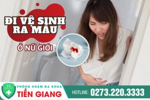 Những Căn Bệnh Khiến Nữ Giới Đi Vệ Sinh Ra Máu - Tìm Hiểu Ngay Nguyên Nhân Gây Bệnh