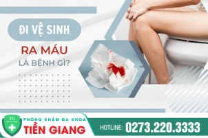 Không Nên Chủ Quan Khi Đi Vệ Sinh Ra Máu Và Đau Rát Hậu Môn - Dấu Hiệu Bệnh Lý Nguy Hiểm