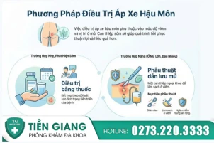Điều trị áp xe hậu môn như thế nào? Phương pháp an toàn hiện nay
