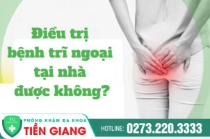 Điều trị trĩ tại nhà được không? Cách chữa bệnh trĩ ngoại hiệu quả hiện nay